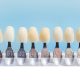 dental-veneers