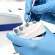Veneers Las Cruces
