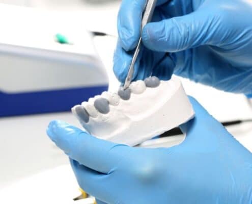 Veneers Las Cruces