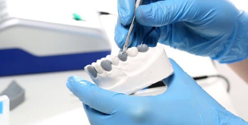 Veneers Las Cruces