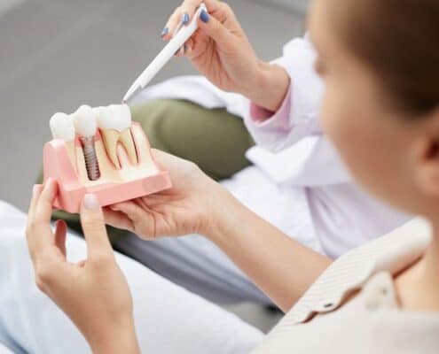Benefits of Dental Implants
