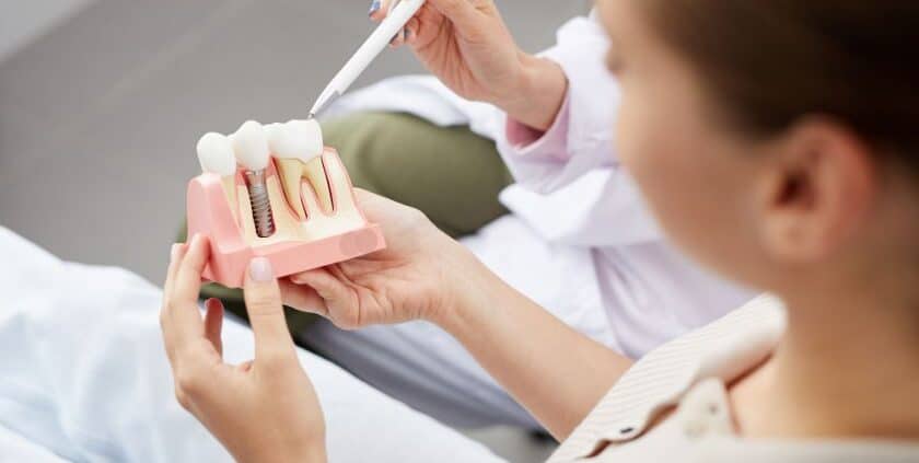 Benefits of Dental Implants