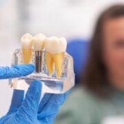 Dental Implants Las Cruces