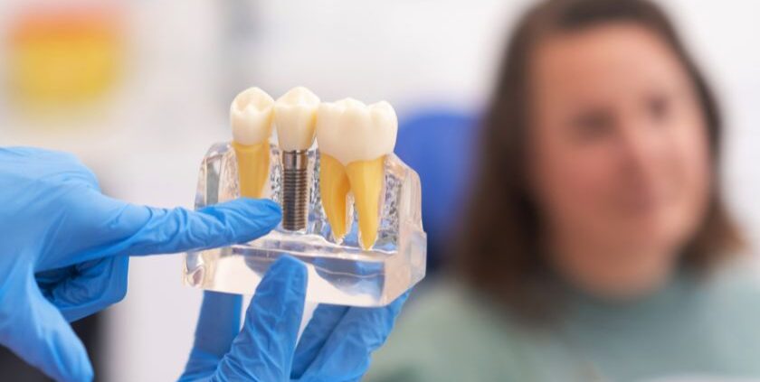 Dental Implants Las Cruces