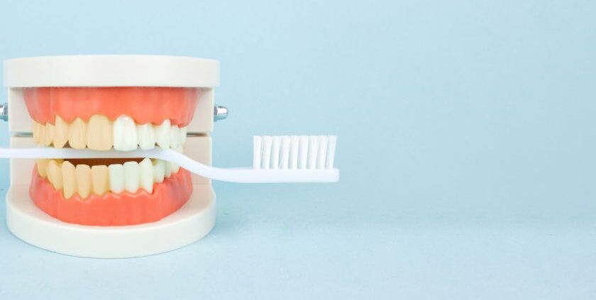 Teeth Whitening Las Cruces