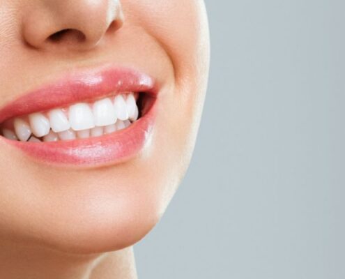 Teeth Whitening Las Cruces