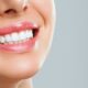 Teeth Whitening Las Cruces