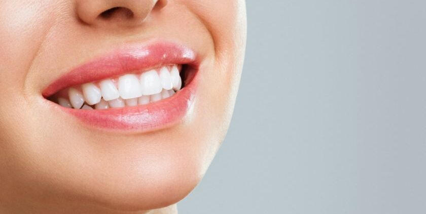Teeth Whitening Las Cruces