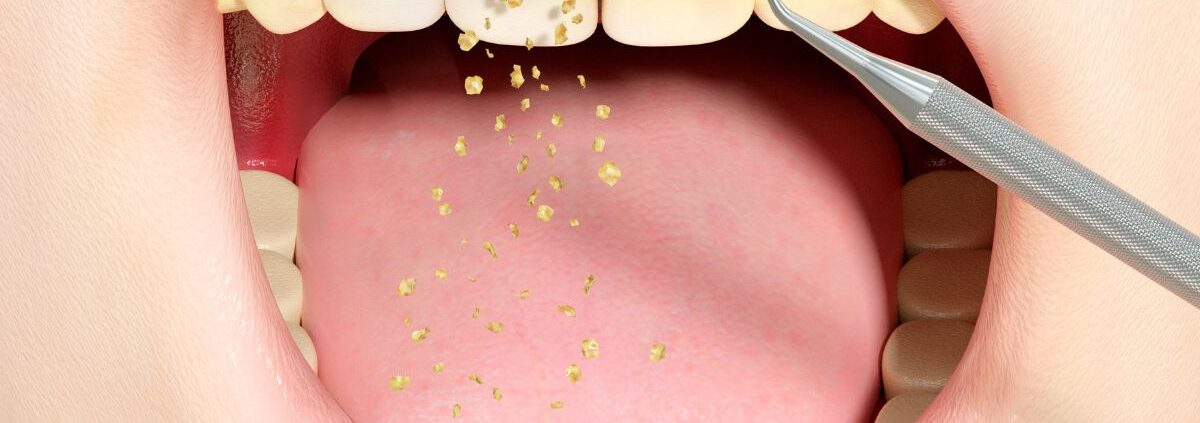 Periodontal Disease Treatment Las Cruces
