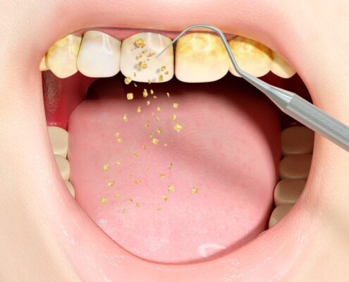 Periodontal Disease Treatment Las Cruces