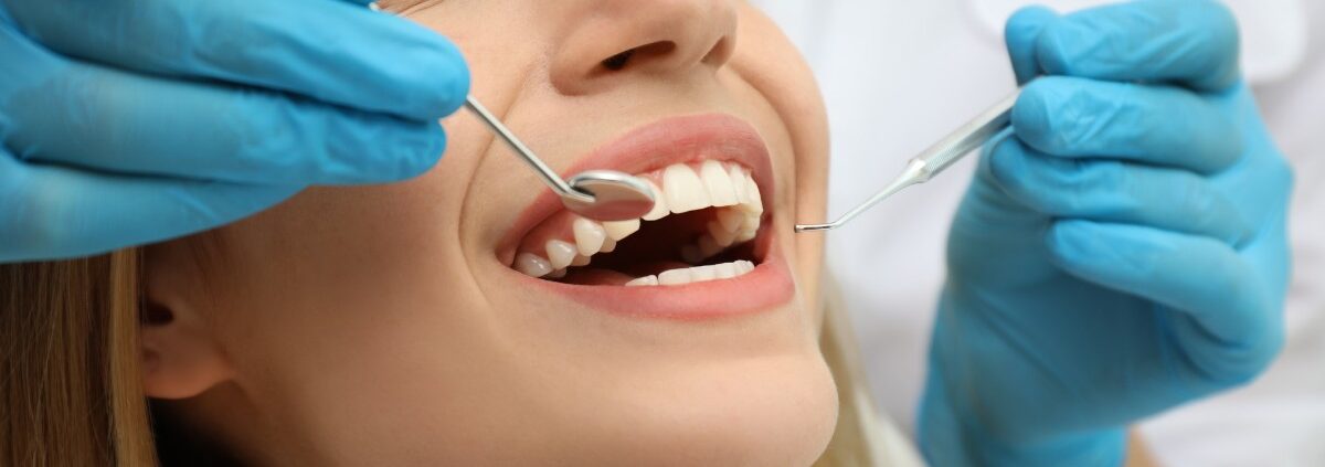 Top 5 Cosmetic Dentistry Treatments for a Radiant Smile