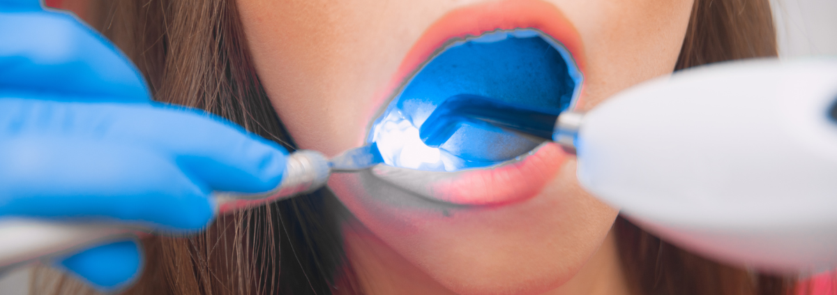 Understanding Restorative Dentistry vs Cosmetic Dentistry