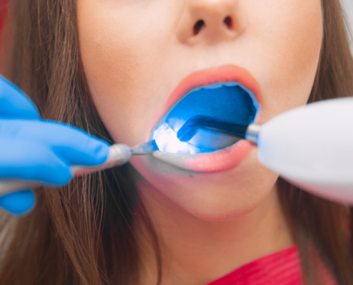 Understanding Restorative Dentistry vs Cosmetic Dentistry