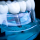 Dental Implants and Beyond: Discover the Hidden Benefits You Didn’t Know About
