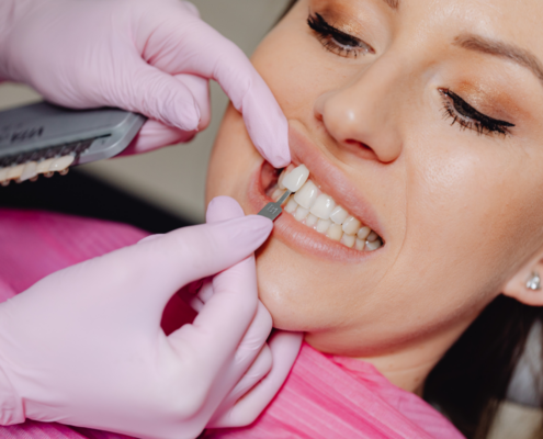 Are Veneers in Las Cruces the Secret to Achieving Your Dream Smile