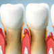 The Hidden Dangers of Periodontal Disease and Effective Treatments