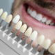 Can Veneers Be Whitened? Tips for a Bright Smile