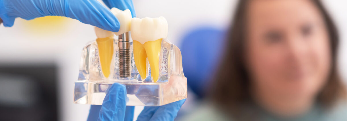 Dental Implants in Las Cruces