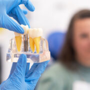 Dental Implants in Las Cruces